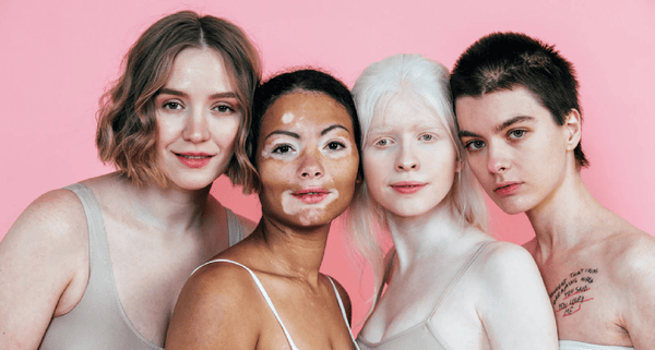 Body Positivity: Self-Love is True Empowerment
